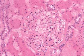macula densa Bubreg (kora) dovodna arteriola bubreæno tjeleπce proksimalni zavijeni kanaliê