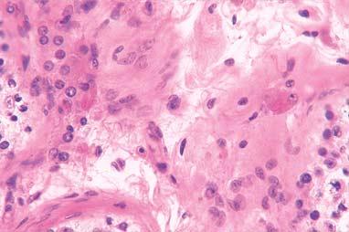 26. TESTIS I EPIDIDYMIS Sl. 234.