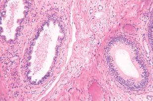 26. TESTIS I EPIDIDYMIS Sl. 237.