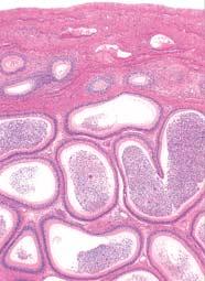 Sjemenovod arteria testicularis musculus cremaster