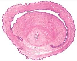 Penis vena dorsalis penis profunda arteria dorsalis penis corpora cavernosa penis koæa