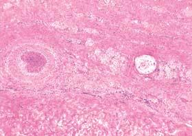 Penis (koæa) zalisci limfna æila arterija Sl.