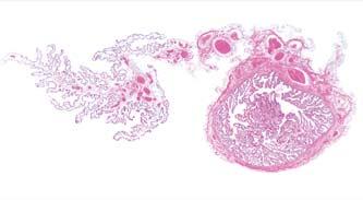 albicans (fibrosum) arterije u sræi jajnika Sl. 265.