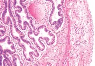 Maternica (predmenstruacijska faza) zona basalis endometrij miometrij
