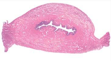 Maternica (djevojëica) parametrij (ligamentum latum uteri) parametrij