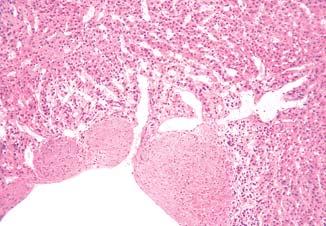 31. ENDOKRINE ÆLIJEZDE zona reticularis Sl. 297.