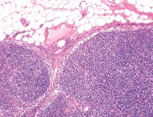 Limfni Ëvor (kora) subkapsularni sinus pregrada (trabekula) intermedijarni (kortikalni)