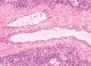 trabekule trabekularna arterija crvena pulpa Sl. 311.
