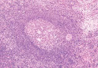 arterije limfni ËvoriÊ limfni ËvoriÊ Sl. 313.