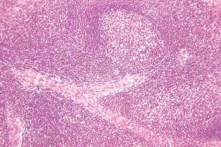 centralna arterija Sl. 314.