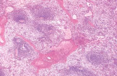 316. venski sinus Slezena (crvena pulpa) trabekula vena