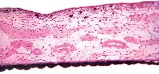 prednja ploha πarenice Sl. 331.