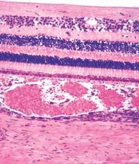 centralis retinae Oko (mreænica) vanjski mreæasti sloj vanjski zrnati sloj sloj πtapiêa i ËunjiÊa pigmentni