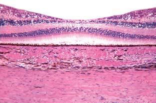 Oko (papilla nervi optici) arteria centralis retinae arteria ciliaris posterior