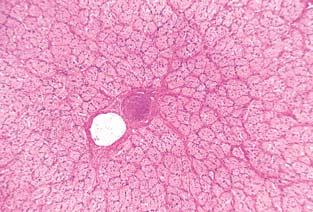 centralis retinae pia mater arachnoidea dura mater Sl.