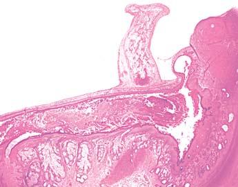 34.UHO puænica perilimfatiëki prostor predvorja nervus cochlearis sakulus utrikulus Sl. 346.