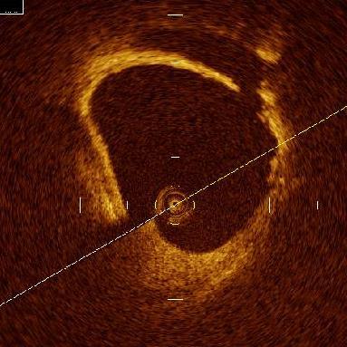 Cardiology.