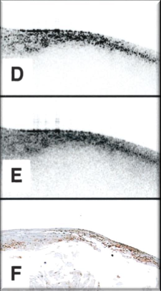 (log 10) R=0.84 (P<0.