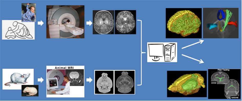 Α ι ό ι ο έ ς ο ά θ ο ι ή ο ο φί φά ο (MRI)