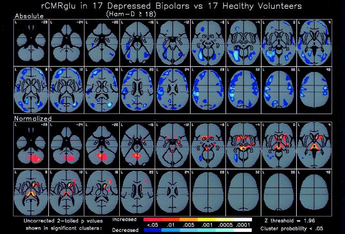 fmri