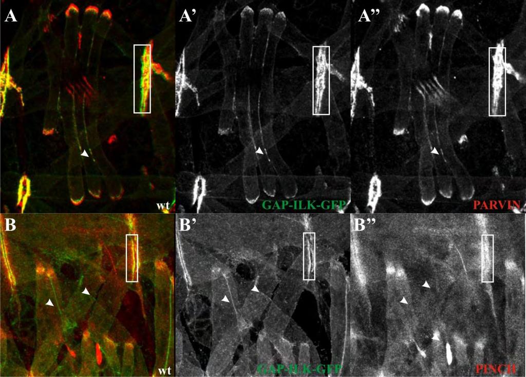 Δηθόλα 23: Η GAP-ILK-GFP εληνπίδεηαη ζηελ πιαζκαηηθή κεκβξάλε θαη ε ύπαξμε ηεο ζηελ πιεπξηθή κεκβξάλε είλαη ηθαλή λα ζπγθεληξώζεη ηε parvin ζε έθηνπεο ζέζεηο εληνπηζκνύ.