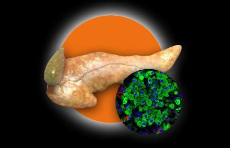 Η δυσοίωνη οκτάδα (The Ominous Octet) Νησιδιακό β-κύτταρο Διαταραγμένη έκκριση ινσπυλίνης Μειωμένη ινκρετινική δράση Αυξημένη λιπόλυση Νησιδιακό α-κύτταριο