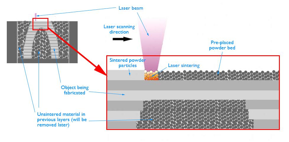 Εμφύτευση με LASER.