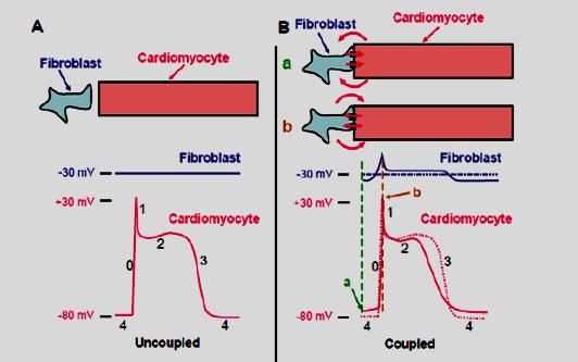 Yue L & Nattel S. Cardiovasc Res 2011 Myocardial fibrosis & electrical conductivity Increased myofibroblast infiltration further affects conductivity.