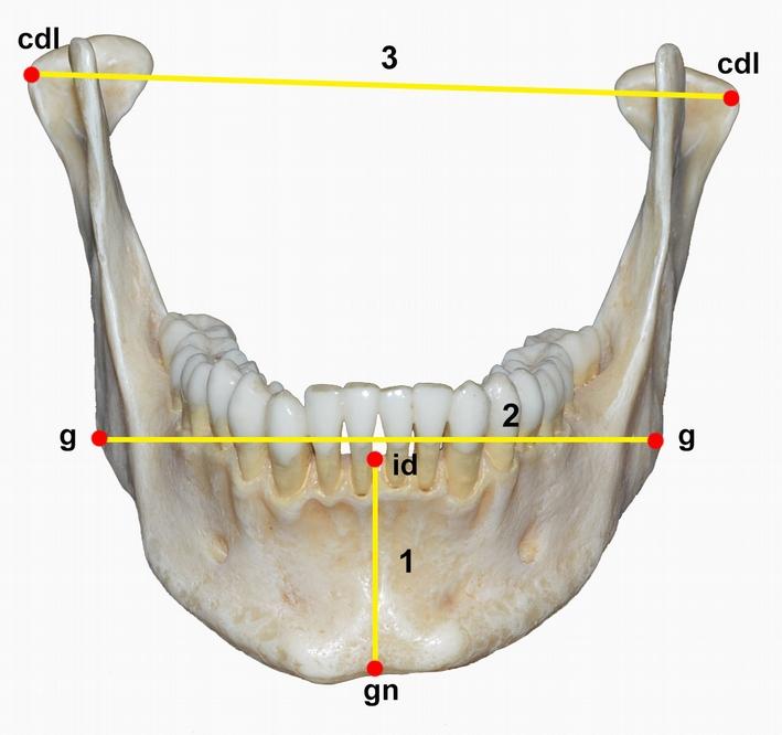 Β. Κάτω γνάθος 1. Ύψος γνάθου: Η απόσταση μεταξύ της κορυφής του φατνίου μεταξύ των κεντρικών τομέων και του γναθίου. 2.
