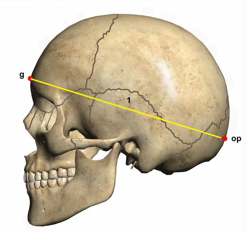 Α2. Καθορισμός κρανιακών μετρήσεων 1. Μέγιστο μήκος κρανίου (g-op): Η απόσταση από το οπισθοκράνιο (op) μέχρι το μεσόφρυο (g) Όργανο: Κεφαλόμετρο 2.