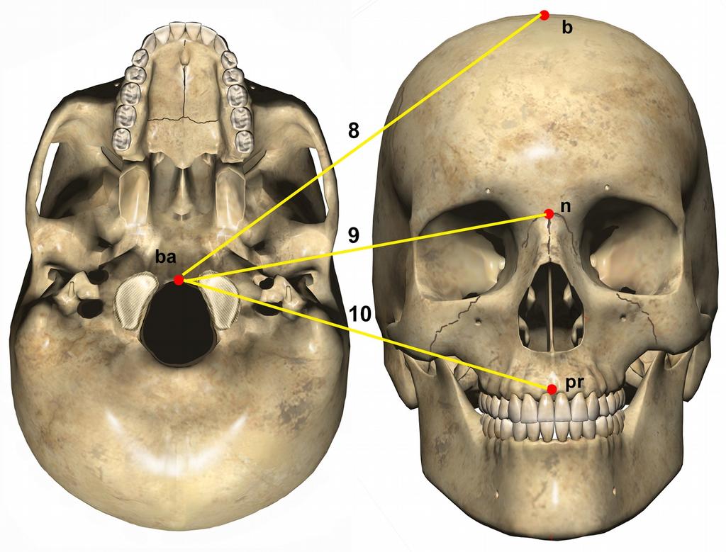 8. Μέγιστο ύψος κρανίου ή Βασιοβρεγματικό ύψος (ba-b): Η μέγιστη απόσταση μεταξύ βασίου (ba) και βρέγματος (b) Όργανο: Κεφαλόμετρο 9.