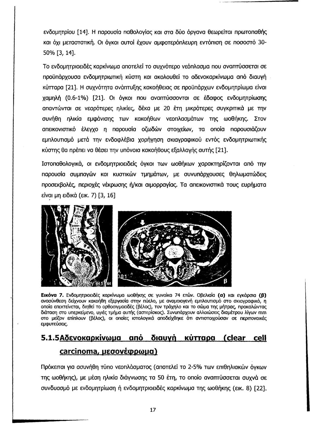 ενδομήτριου [14]. Η παρουσία παθολογίας και στα δύο όργανα θεωρείται πρωτοπαθής και όχι μεταστατική. Οι όγκοι αυτοί έχουν αμφοτερόπλευρη εντόπιση σε ποσοστό 30-50% [3, 14].