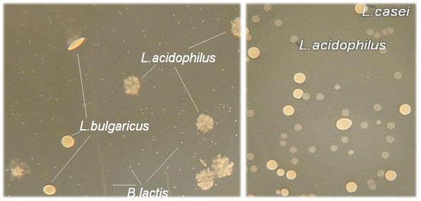 Lactobacillus: Το γένος αυτό περιλαμβάνει Gram+, αρvητικά στηv καταλάση ραβδία πoυ συχvά σχηματίζουν μακριές αλυσίδες.