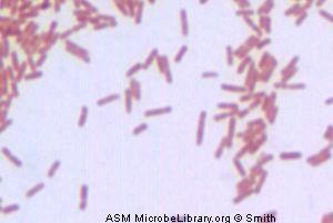 coli) Pseudomonas (P. putida, P. fluorescens, P.