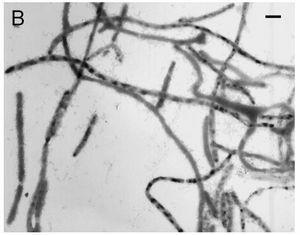 (παράγουν άλκαλι) Psychrobacter spp. Xanthomonas spp.