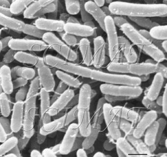 enterica serovar Typhimurium) Shigella spp. (S. dysenteriae) Yersinia spp. (Y. enterocolitica) Vibrio spp. (V.