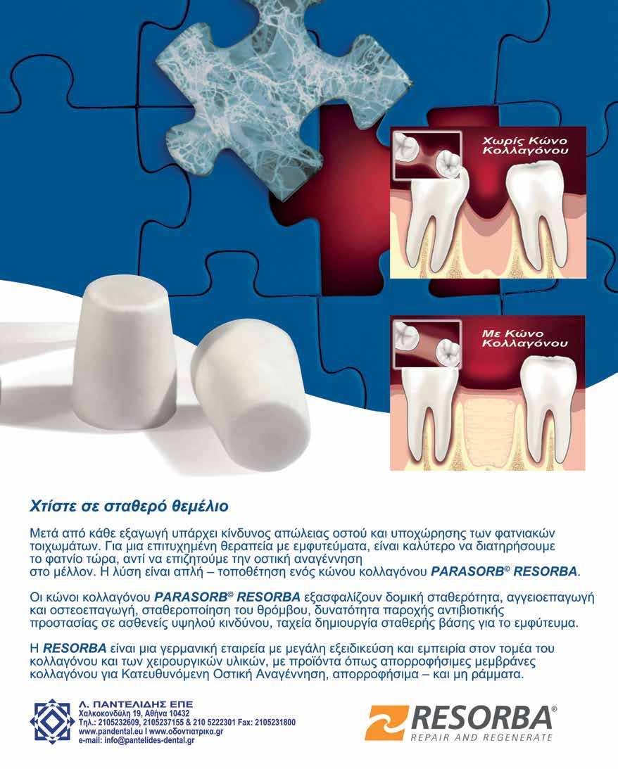 Εν συντομία 14 Dental tribune Greek Edition Οδοντόπαστα που ανιχνεύει την οδοντική πλάκα μπορεί να βοηθήσει στη μείωση του κινδύνου εγκεφαλικού και καρδιαγγειακών επεισοδίων By DTI Οι ειδικοί στον