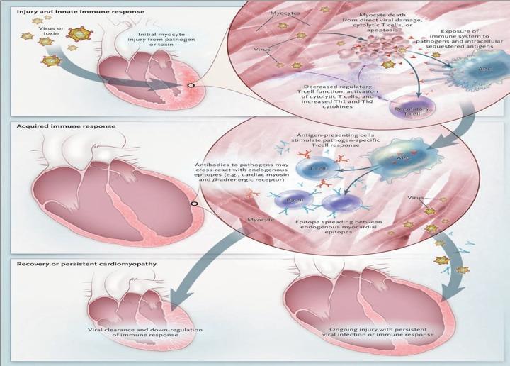 Pathology - Robbins