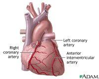 Στη χρόνια καρδιακή ανεπάρκεια η καρδιά διογκώνεται και χάνει την ικανότητά της να αντλεί επαρκείςποσότητεςαίματος.