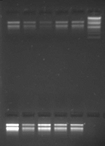 07:30,09:30,14:00,19:00 και 21:30. Ο έλεγχος της ποιότητας του RNA έγινε κατόπιν ανάλυσης των δειγμάτων με ηλεκτροφόρηση σε πηκτή αγαρόζης 1,5% (Εικόνα 3).
