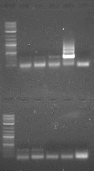 Εικόνα 5: Στην πάνω σειρά (από αριστερά προς τα δεξιά) παρατηρούμε πρώτα το μάρτυρα μοριακών βαρών, έπειτα τα 3 δείγματα αγρίου τύπου (wild type 07:30, 14:00, 19:00), δίπλα ένα παλαιότερο δείγμα cdna