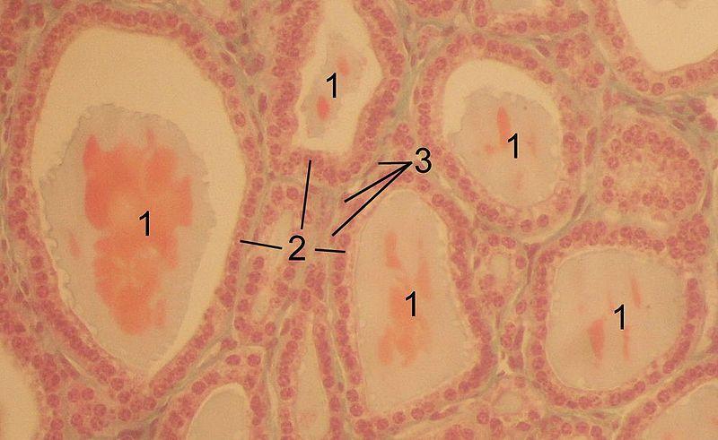 Ο ΡΟΛΟΣ ΤΟΥ ΘΥΡΕΟΕΙΔΗ ΣΤΗ ΔΙΕΓΕΡΣΗ ΤΩΝ ΩΟΘΗΚΩΝ 31 Εικόνα 1. Ιστολογικό παρασκεύασμα από θυρεοειδικά κύτταρα αλόγου. 1: θυλάκια, 2: θυλακιώδη κύτταρα του επιθηλίου, 3: ενδοθηλιακά κύτταρα.