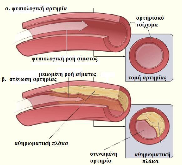 ΙΑΤΡΙΚΕΣ ΑΡΧΕΣ ΤΟΥ ΜΑΝΙΤΑΡΙΟΥ ΓΑΝΟΔΕΡΜΑ Κλινικά πειράματα έχουν αποδείξει τις βασικές λειτουργίες του Κατεβάζει τα επίπεδα της χοληστερόλης και του ελεύθερου λίπους στο αίμα Μειώνει τα επίπεδα