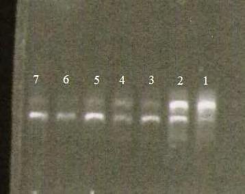 Πίνακας 32. Τα συστατικά της αντίδρασης PCR.