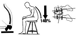 NEPRAVILNA DRŽA PRI SEDENJU Slika 25: Nepravilno sedenje nepravilne obremenitve hrbtenice Vir: www.stari.fnm.uni-mb.
