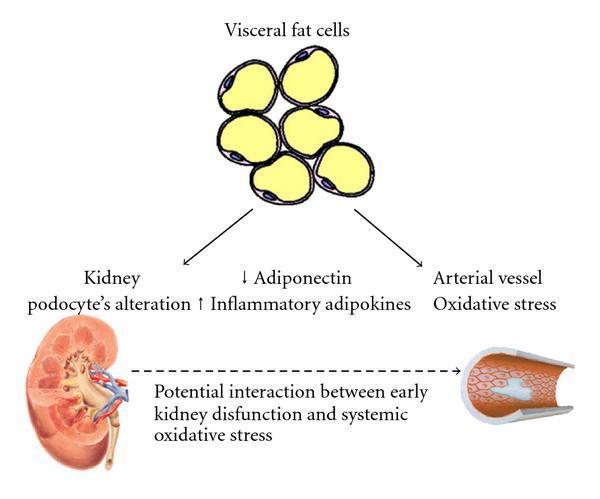 Σχήμα : Πιθανές δυναμικές αλληλεπιδράσεις μεταξύ παχυσαρκίας, χρόνιας νεφρικής ασθένειας και καρδιαγγειακής ασθένειας, Η αύξηση της σπλαχνικής μάζας