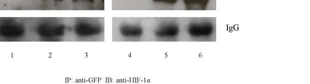 Εικόνα 34 : HeLa κύτταρα επιµολύνθηκαν µε πλασµίδια που εκφράζουν για FLAG (pme18s- FLAG) ή FLAG-MgcRacGAP (pme18s-flag-mgcracgap) και GFP (pegfp-c1) ή GFP-HIF- 1α (pegfp-hif-1α), όπως απεικονίζεται.