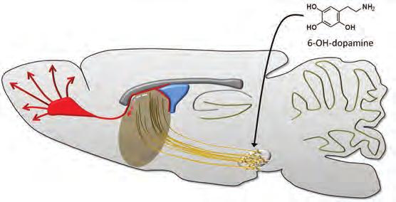 Ipsilateral