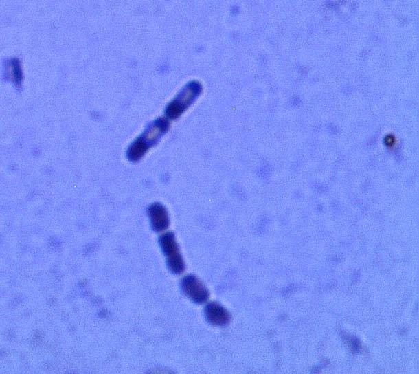1.3. Опште карактеристике врсте Bacillus cereus Род Bacillus обухвата преко 20 врста крупних, правих, Грам позитивних бактерија.