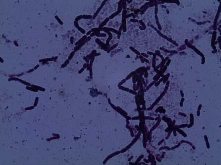 3.3. Резултати поновне идентификације врсте Bacillus cereus Методама које су коришћене за потврду идентификације врсте утврђено је да су испитивани сојеви Грам позитивни покретни штапићи (дијаметар